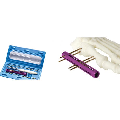 Fixateur externe / für Tarsalknochen - SIDEKICK™ - Wright Medical Technology - rohrförmig / für Erwachsene