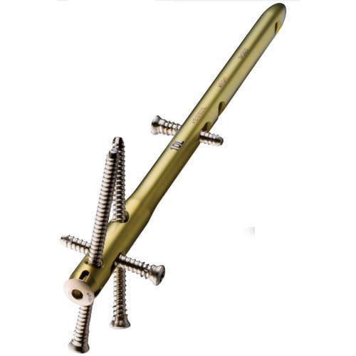 Marknagel / für Knöchel - VALOR™ - Wright Medical Technology - mit distaler Fixierung