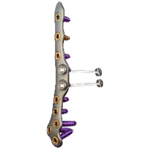 Kompressionsplatte für Tibia - ORTHOLOC™ 2 - Wright Medical Technology - für Fibula / für Knöchel / proximal