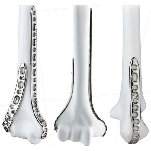 Kompressionsplatte für Radiuskopf - EVOLVE™ EPS - Wright Medical Technology - für Ellbogen / distal / mit Verriegelung