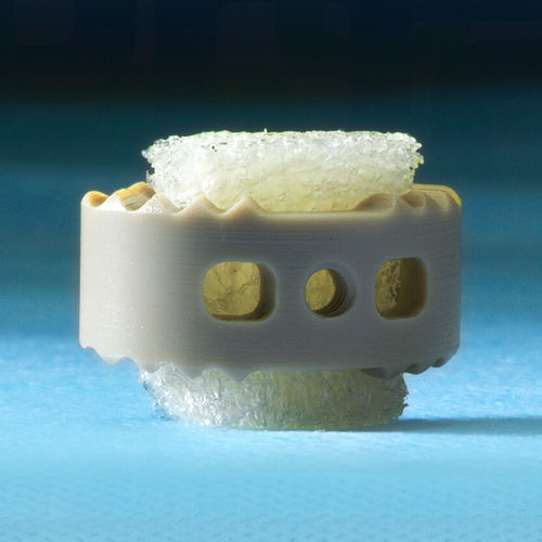Allograft-Knochenersatzmaterial - 3D Profuse® - Alphatec Spine - für orthopädische Chirurgie / formbar