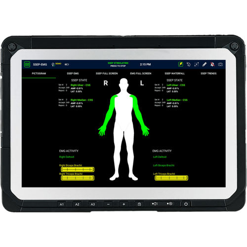 Monitoring-Informationssystem - SafeOp™ - Alphatec Spine - für Neurochirurgie / orthodontisch