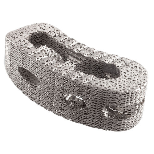 Thorako-lumbales Zwischenwirbelimplantat - IdentiTi™-PC - Alphatec Spine - dorsaler Zugang / Titan