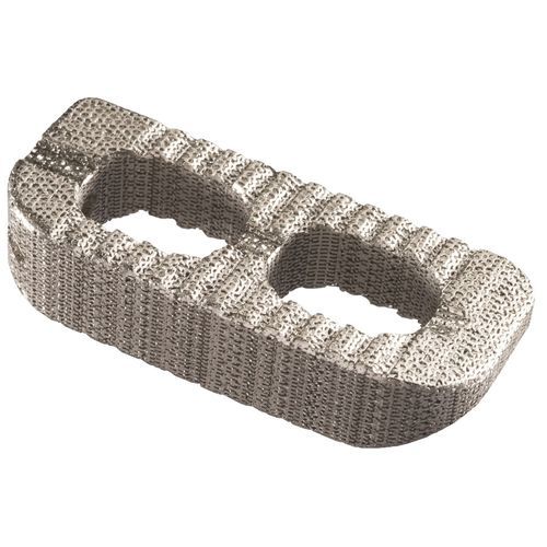 Thorax-Zwischenwirbelimplantat - IdentiTi™ LIF - Alphatec Spine - lateraler Zugang / Titan