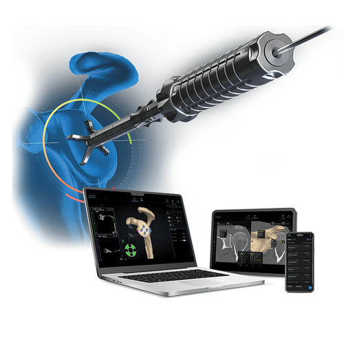 Software / Präoperative Planung - VIP - Arthrex - Kalibrierung / für orthopädische Chirurgie