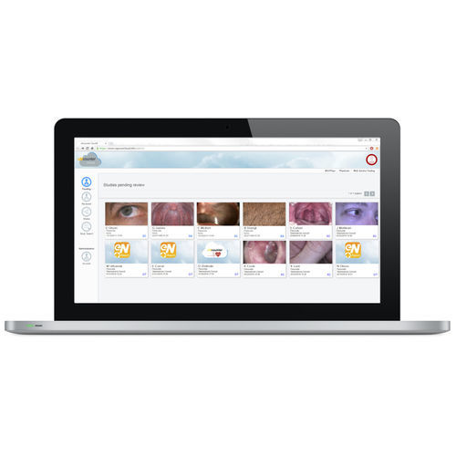 Cloud-Software - eNcounterCloud® - GlobalMed - Bildanalyse / Datenverwaltung / für Patientendatenverwaltung