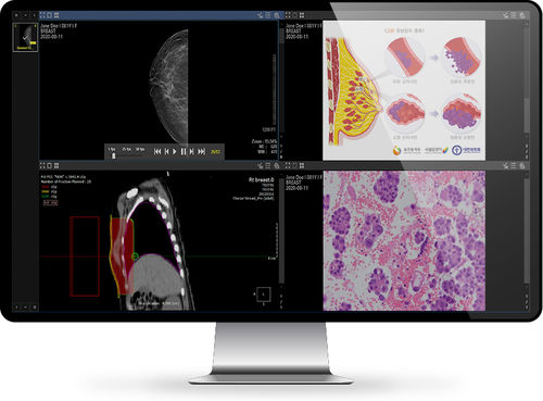 Management-Software - INFINITT North America - Content-Sharing / für Kliniken / für medizinische Bildgebung