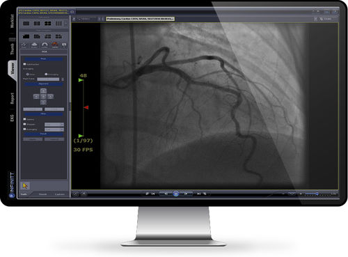 Analysesoftware - Cath Lab - INFINITT North America - Management / medizinisch / Kardiologie