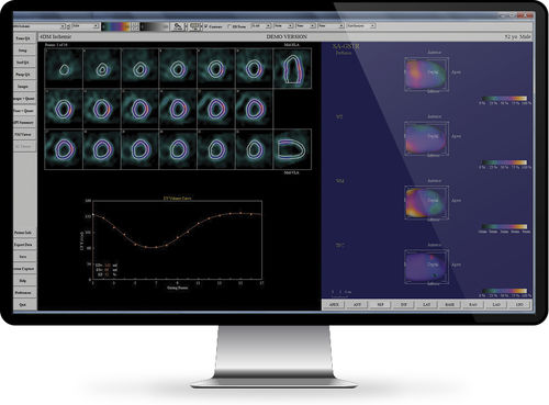 Reporting-Software - INFINITT North America - Viewer / Nachbearbeitung / für Kliniken