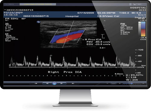 Datenverwaltungssoftware - INFINITT North America - medizinisch / für Krankenhaus / Kardiologie