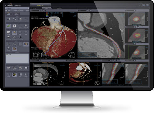 Analysesoftware - Xelis™ Cardiac - INFINITT North America - 3D-Visualisierung / Diagnose / Mess