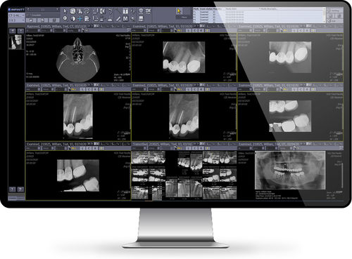 PACS für medizinische Bildgebung - Dental  - INFINITT North America - webbasiert