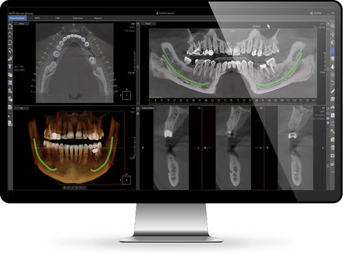 Reporting-Software - Xelis™   - INFINITT North America - Visualisierung / Diagnose / Planung