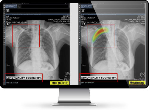 Medizinische Software - INFINITT North America - für Radiologie / Bildanalyse / Viewer