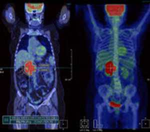 Analysesoftware - Xelis™ Fusion - INFINITT North America - 3D-Visualisierung / multimodale Bildfusion / für medizinische Bildgebung