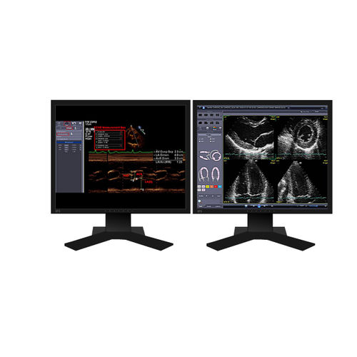 Software für Echokardiographie - INFINITT North America - Reporting / Visualisierung / Diagnose