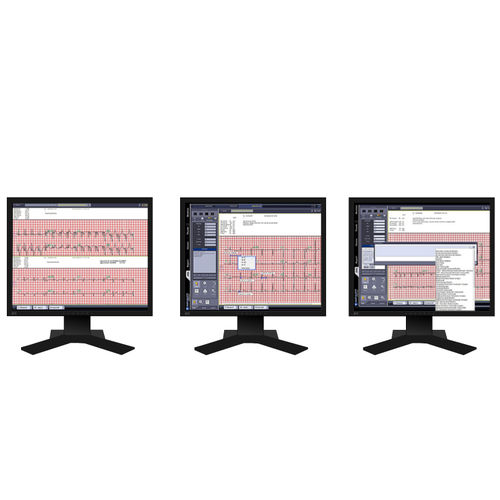 Verwaltungs- und Analysesystem / Visualisierung - INFINITT North America - EKG