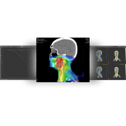 Anatomie-Software - MIM SureCalc® MonteCarlo - MIM Software - für medizinische Bildgebung / Strahlendosimetrie / Mess