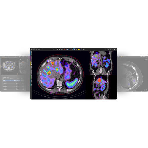 Anatomie-Software - MIM SurePlan™ MRT - MIM Software - für Nuklearmedizin / Reporting / Strahlendosimetrie