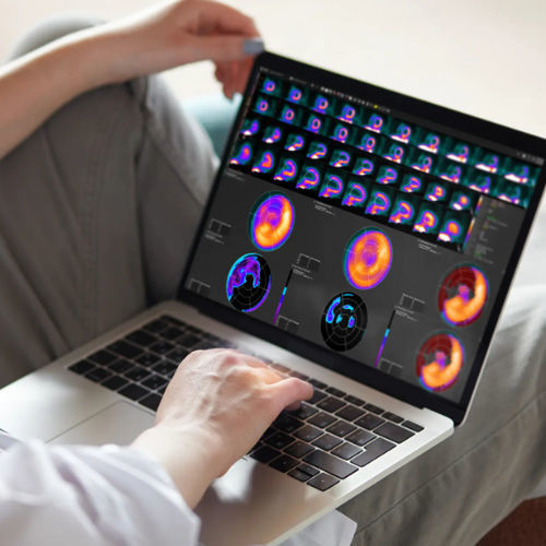 Analysesoftware - MIMcardiac® - MIM Software - für Kliniken / Computertomographie / TEP