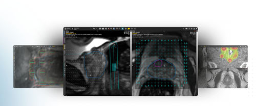 3D-Visualisierung-Software - MIM Symphony LDR™ - MIM Software - Beschaffung / Planung / Behandlungsplanung
