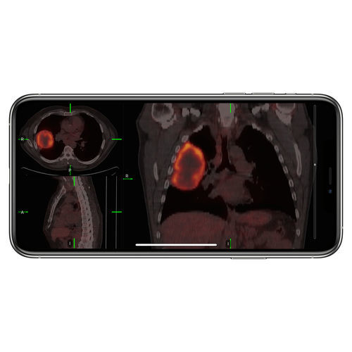 IOS-Applikation / Zutritts - VueMe™ - MIM Software - Import / für medizinische Bildgebung / iOS