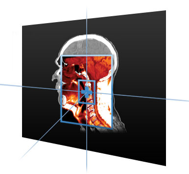 Medizinische Software - MIM Maestro® - MIM Software - für Strahlentherapie / Visualisierung / Planung
