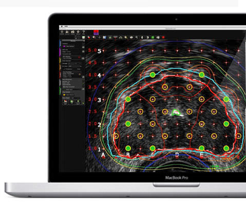 Analysesoftware - MIM Symphony Dx™ - MIM Software - Management / Reporting / Visualisierung