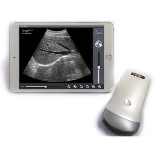 Ultraschall-Handgerät - SS-1, SS-2 - SonopTek - für Multifunktions-Ultraschall / drahtlose Sonde