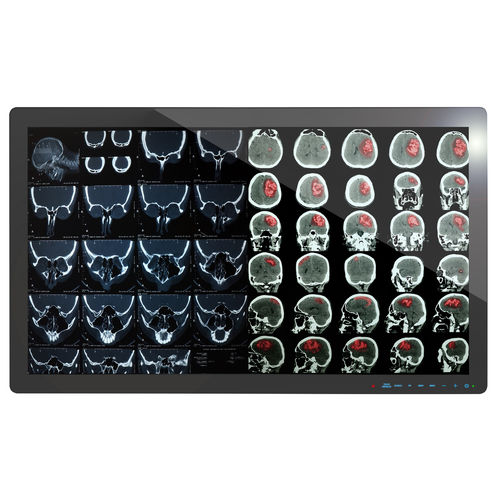 Monitor / Full HD - 4K2K - Richardson Electronics - Healthcare - 4K / 32" / LCD