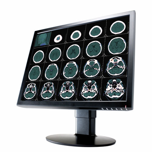Medizinisch Monitor - 2 MP | CL2000 - Richardson Electronics - Healthcare - Diagnose / für Radiologie / 20,1"