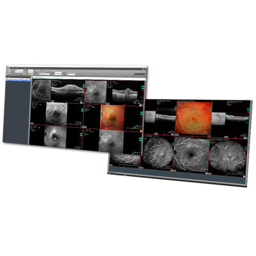 Medizinischer PACS - HEYEX  - Heidelberg Engineering