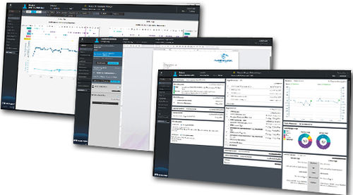 Reporting-Software - HEYEX - Heidelberg Engineering - Umform / Aufzeichnung / Erfassung
