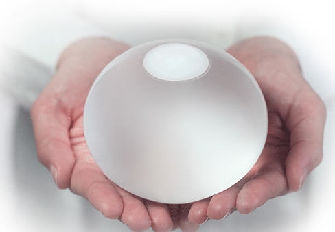 Nicht-chirurgischer Magenballon - ORBERA® - Apollo Endosurgery