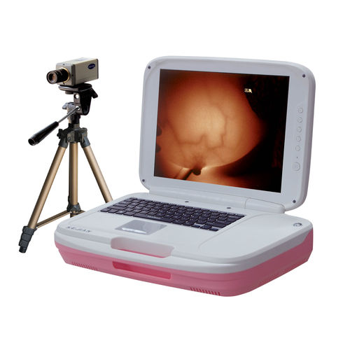 Videokolposkop - AD-1202 - Xuzhou Kejian Hi-tech - tragbar