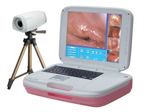 Videokolposkop - AD-2000Y  - Xuzhou Kejian Hi-tech - tragbar