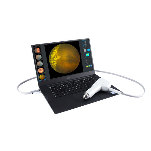 Nicht-mydriatische Funduskamera - SW-8000P - Tianjin Suowei Electronic Technology - fluoreszierende Angiographie des Auges / Handgerät