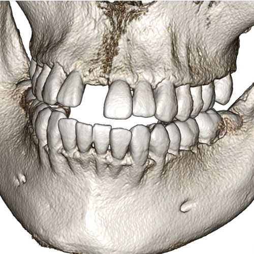 Dental-Software -  Invivo6 - Anatomage - medizinisch / Computertomographie / Analyse