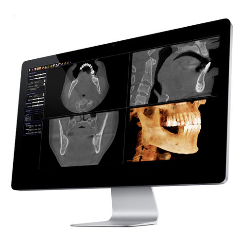 3D-Visualisierung-Software - Invivo - Anatomage - Mess / Content-Sharing / medizinisch