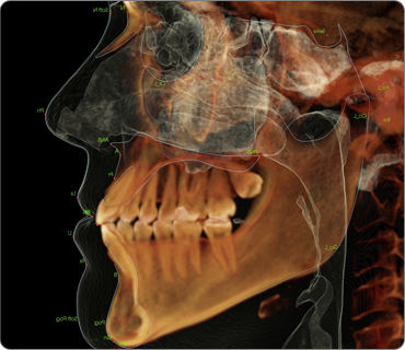 Software-Modul / Fernröntgen - Anatomage - 3D-Simulation / für dentale Bildgebung / orthodontisch