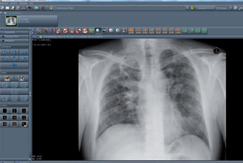 Visualisierungssoftware - NEXUS / PACS - Nexus AG - für PACS / medizinisch / für Krankenhaus