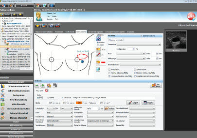 Management-Software - NEXUS / OBSTETRICS - Nexus AG - für gynäkologische Untersuchungen / für geburtshilfliche Untersuchungen