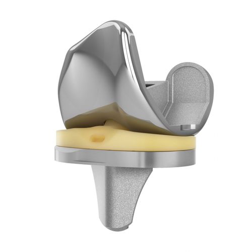 Femur-Patella Knieprothese - EMPOWR PS ® - Trilliant Surgical - mit fester Scheibe