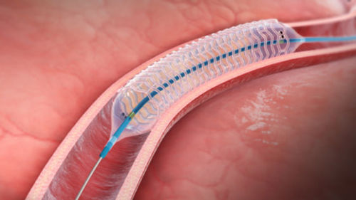 Koronararterien-Stent - DESolve™ - Elixir Medical - PLLA / bioresorbierbar