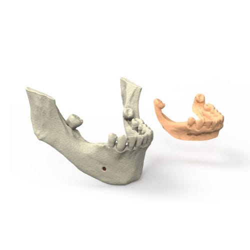 Dental-Software - 3DIEMME - für Chirurgie / für Zahnprothese-Design / dental- implantologische Planung