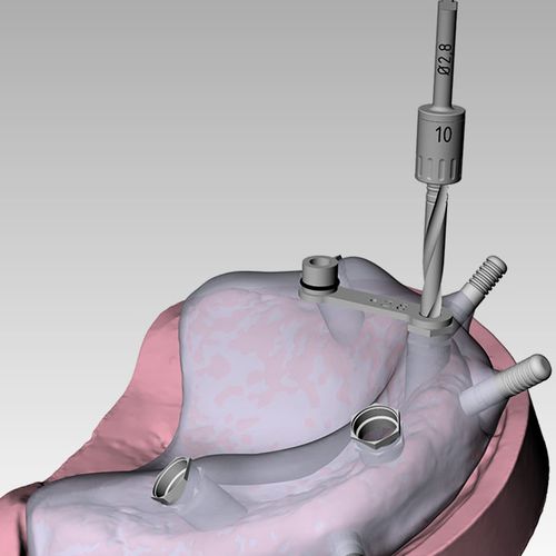 Software für Kliniken - RealGUIDE™ - 3DIEMME - für Zahnchirurgie / für geführte Chirurgie / universell