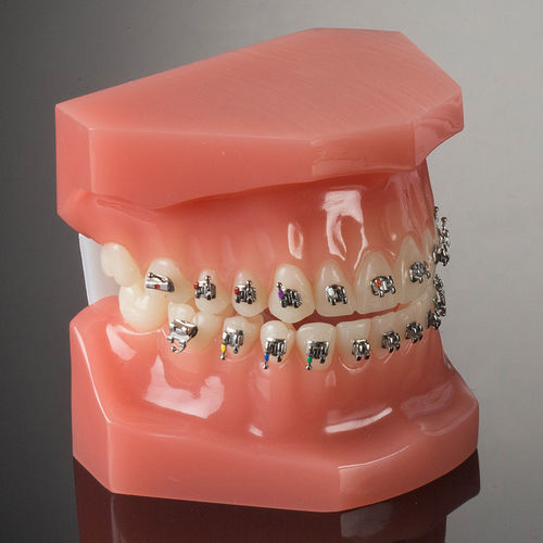 Orthodontie Bracket / Metall - miniPrevail® - G&H Orthodontics - Twin / Mini