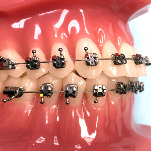 Orthodontie Bracket / Metall - Agility® - G&H Orthodontics - selbstabklemmend