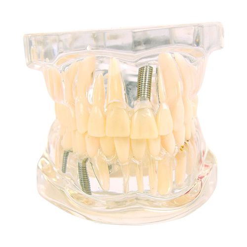 Anatomisches Modell / Zahn - H139074  - HeineScientific® - Dental / Kiefer / Dental