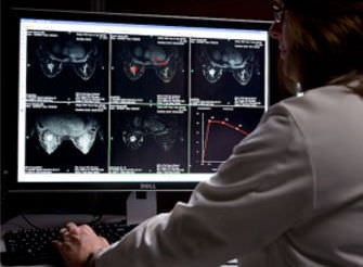 Röntgensoftware - AuroraCAD™ - Aurora Imaging - für Mammographie / Visualisierung / Diagnose